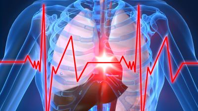 I trigliceridi fattori di rischio per l'infarto